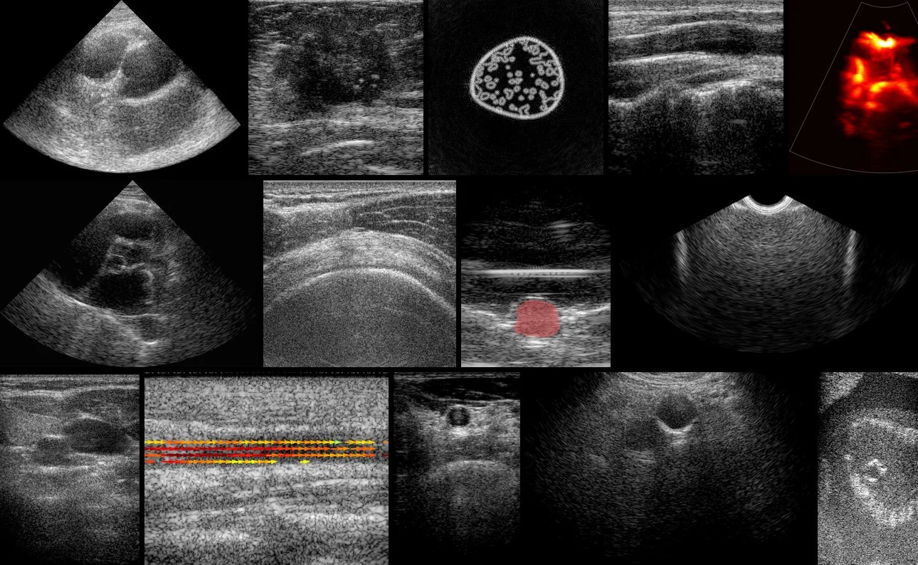 Mosaic of ultrasound images from the OpenH-RF dataset