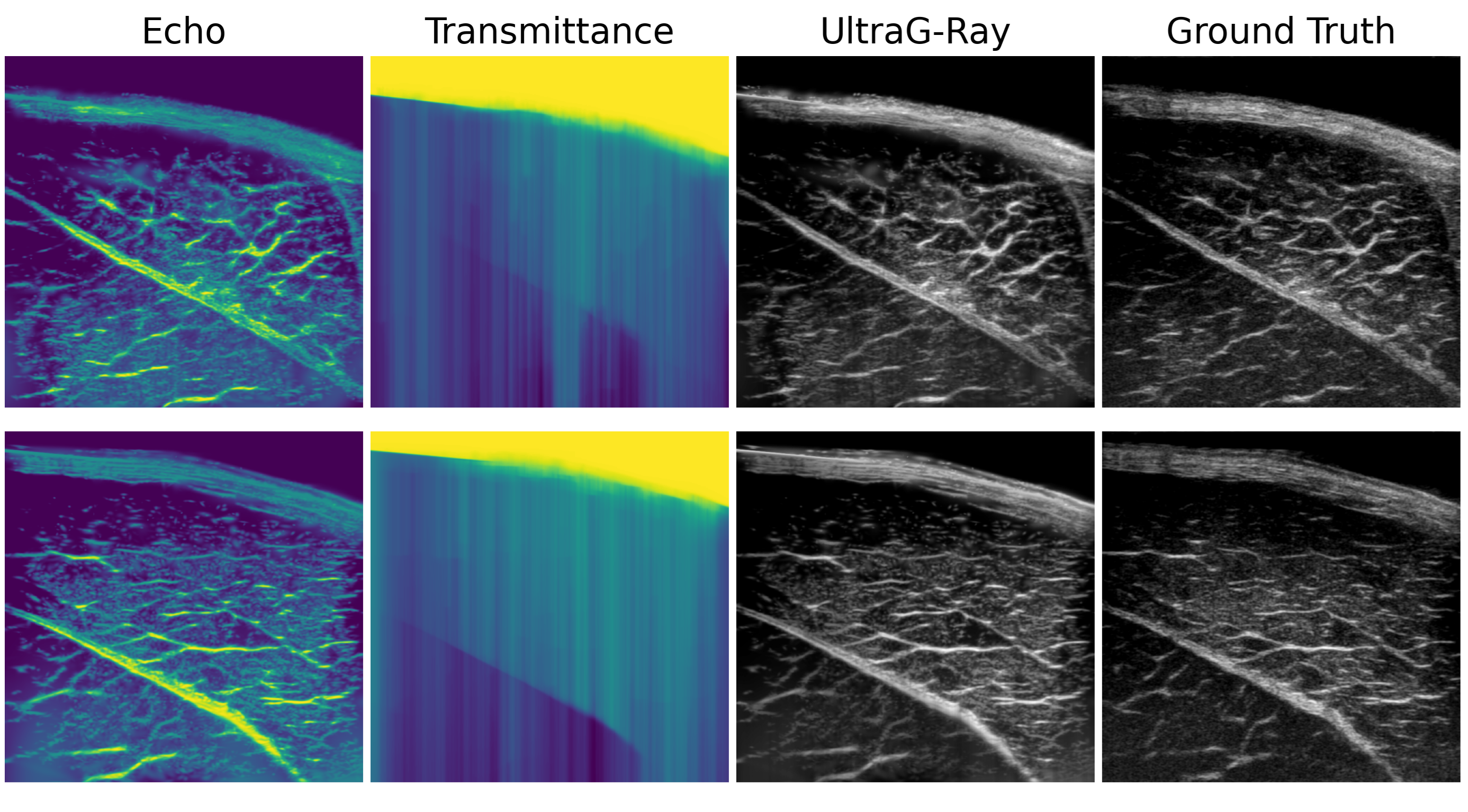 UltraG-Ray teaser image