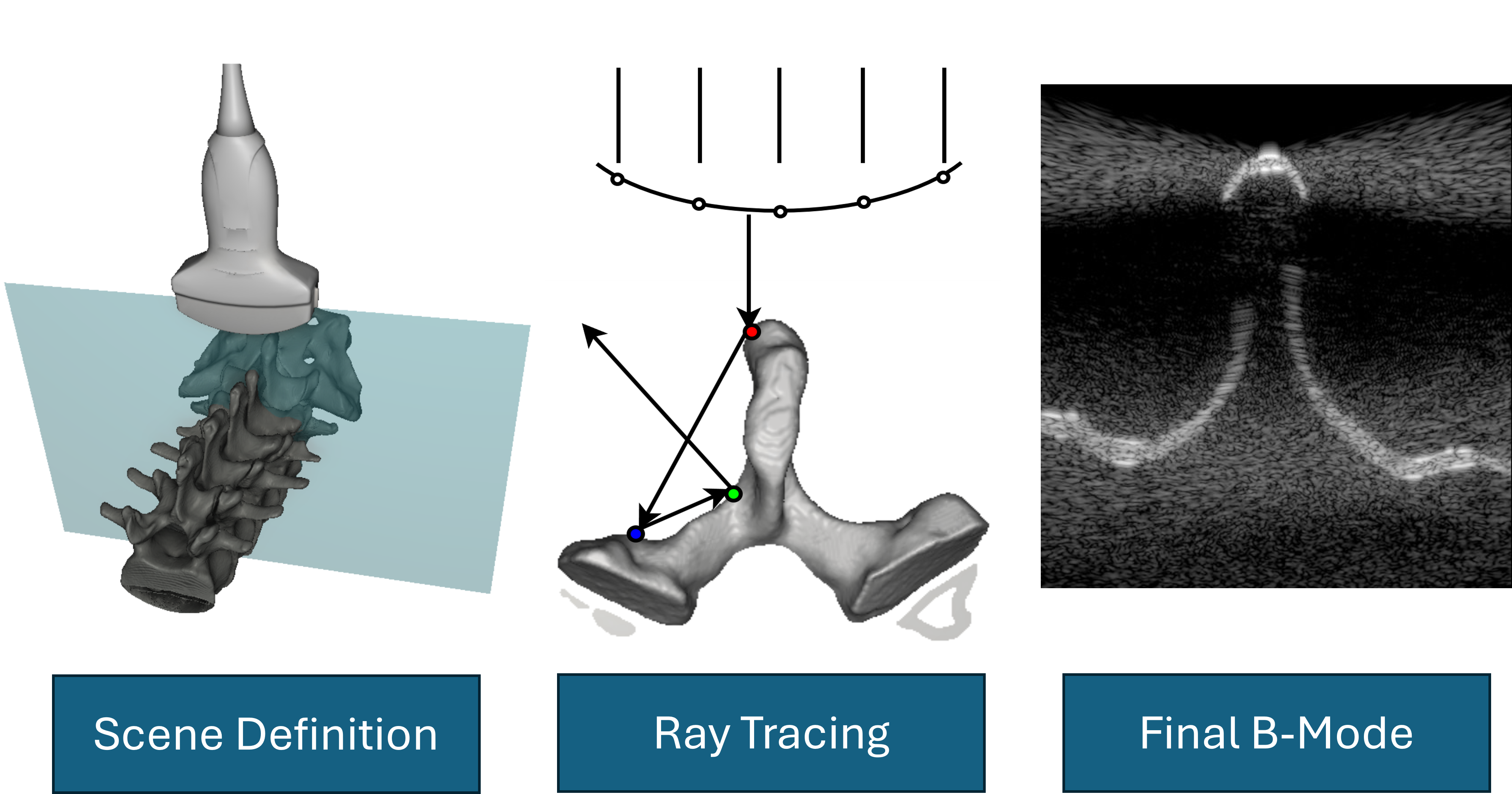 UltraRay teaser image